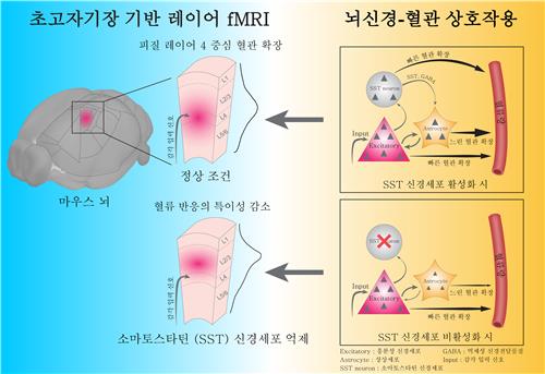 '뇌 속 혈류 조절 열쇠' 억제성 신경세포에서 찾았다