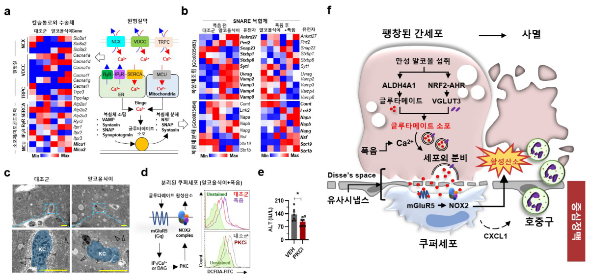 폭음 시 간세포가 면역세포와 '대화'?…알코올성 간질환 핵심 발병 메커니…