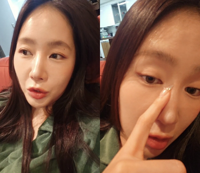 소유, 확 바뀐 얼굴 해명 