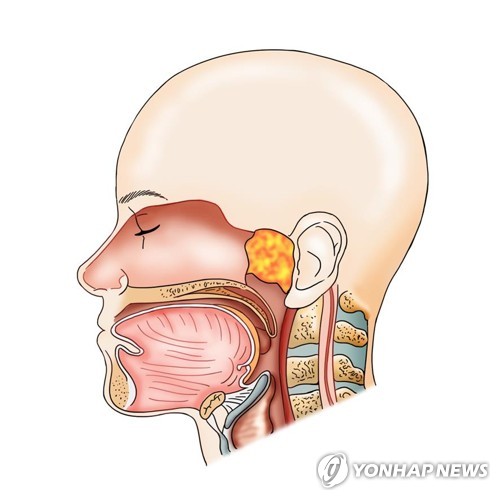 얼굴·목 암수술 대가 80%까지↑…급성 정신질환 입원수가 신설