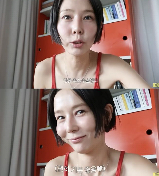 김나영, 성형의혹 입 열었다 "인중축소수술 아닌 메이크업"[SC리뷰]