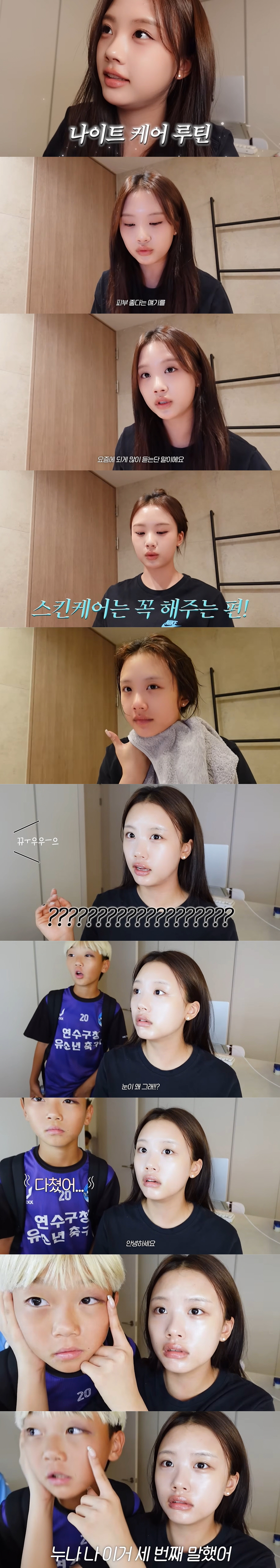 이동국子 시안, 시퍼렇게 멍든 눈...재시도 깜짝 "눈 왜그래?" ('지…