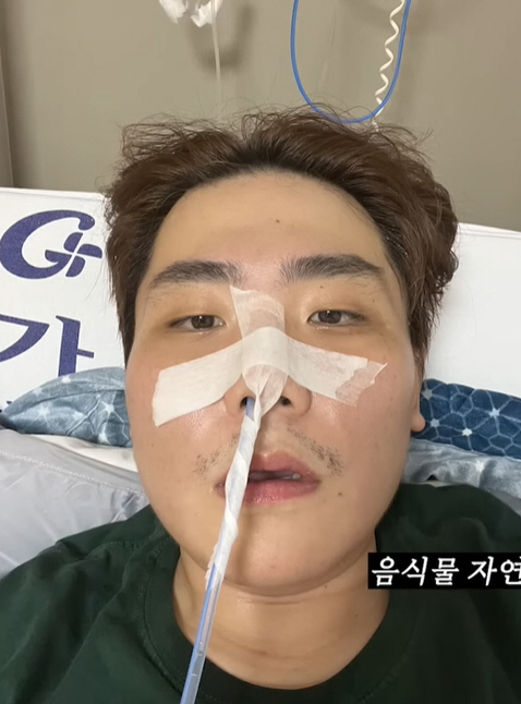 송필근, 췌장 괴사 버텨냈다…"35kg 빠지고 패혈증 직전까지"
