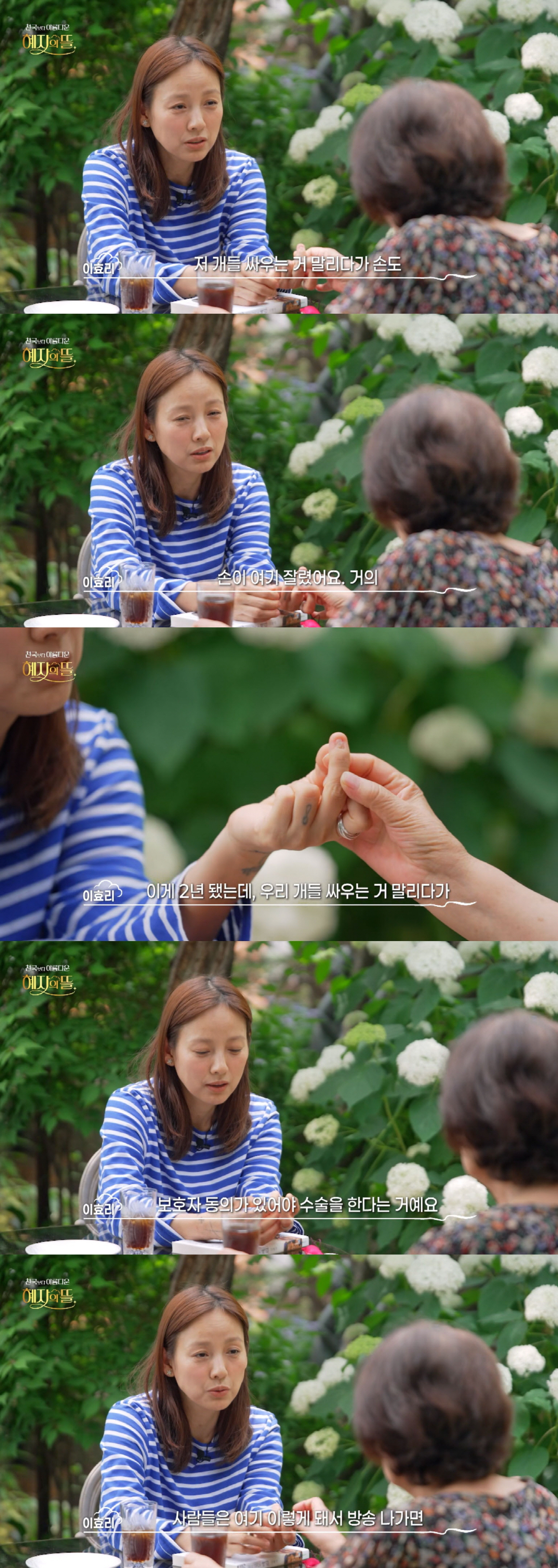 이효리, 아찔 사고 "개싸움 말리다 손 잘릴 뻔, 신경 끊어져"[SC리뷰…
