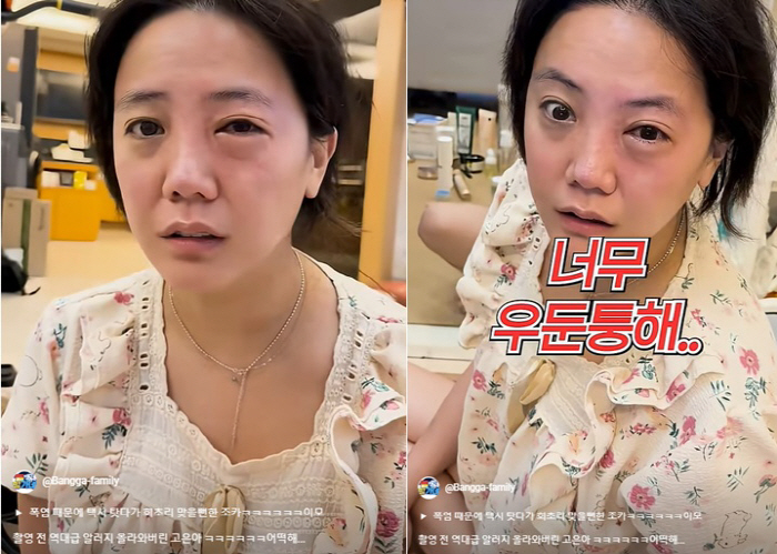 고은아, 촬영 앞두고 눈 퉁퉁.."역대급 알레르기, 병원도 못 가"