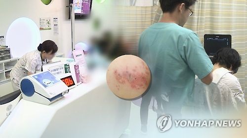 "헤르페스 치료 항바이러스제, 알츠하이머병 지연효과 없어"
