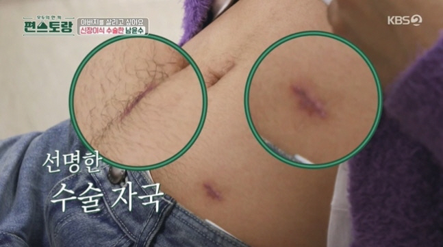 남윤수, 父에 신장 이식→상의탈의 근황…"깊은 흉터는 사랑"