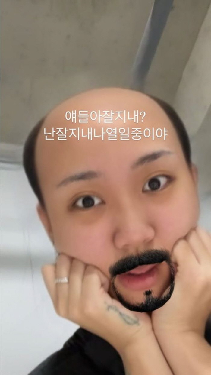 이영지, 손톱 부상 인증 후 팬 4000명 '탈덕'…"가지마"
