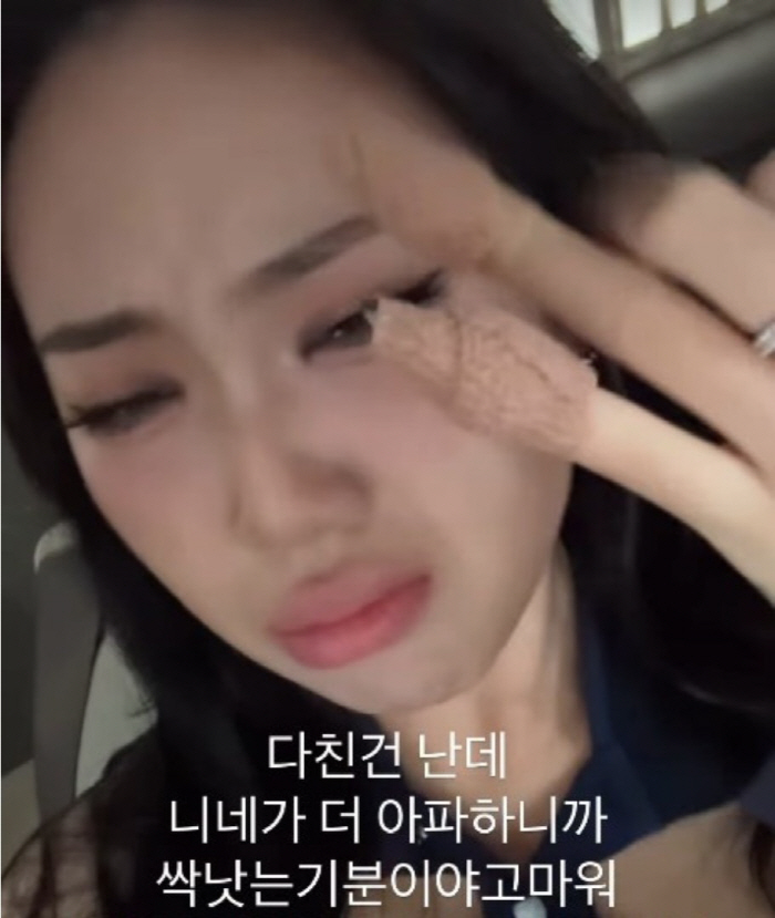 이영지, 손톱 부상 인증 후 팬 4000명 '탈덕'…"가지마"