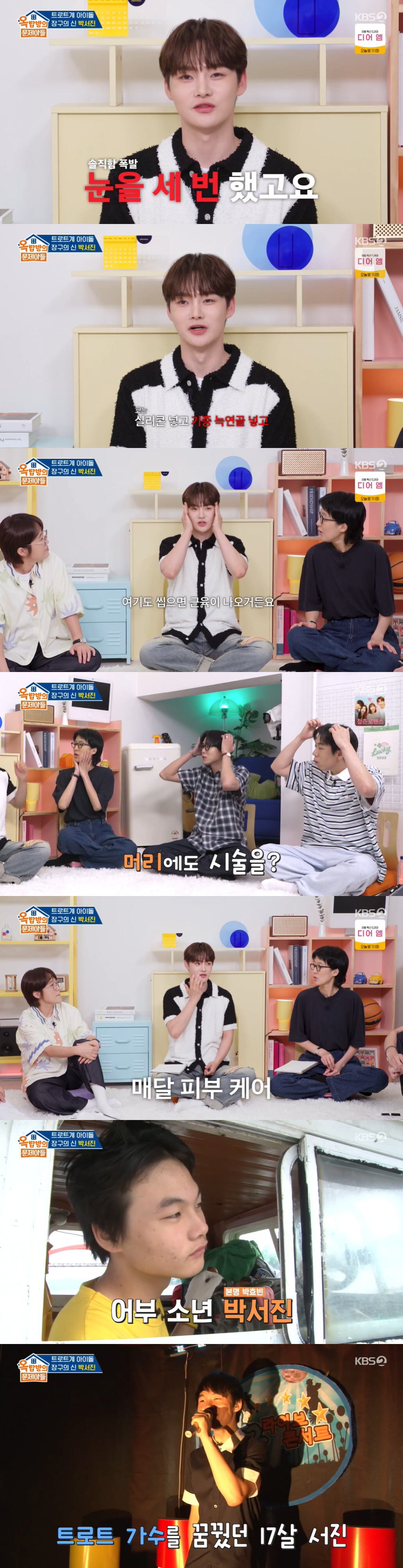 박서진, 페이스오프 급 성형 고백 "눈만 3번→머리·턱 보톡스까지" ('…