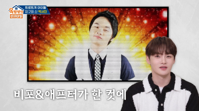 박서진, 성형 비용만 '억대' 스포츠 카 값 "얼굴 갈아 끼워...모발이…