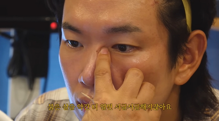장성규, 차은우 닮은꼴로 성형 수술 예고...의사 "다시 태어나야해" (…