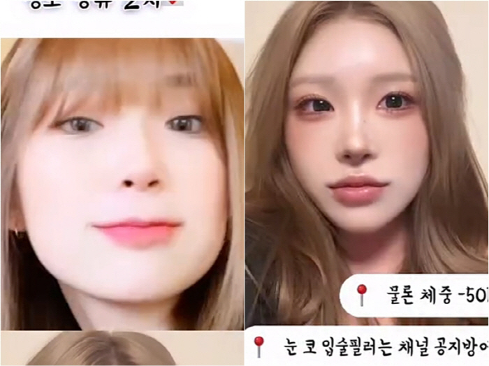 "체중 50kg 감량" 최준희 "눈 뒷밑트임에 안면윤곽까지" 드라마틱한 …