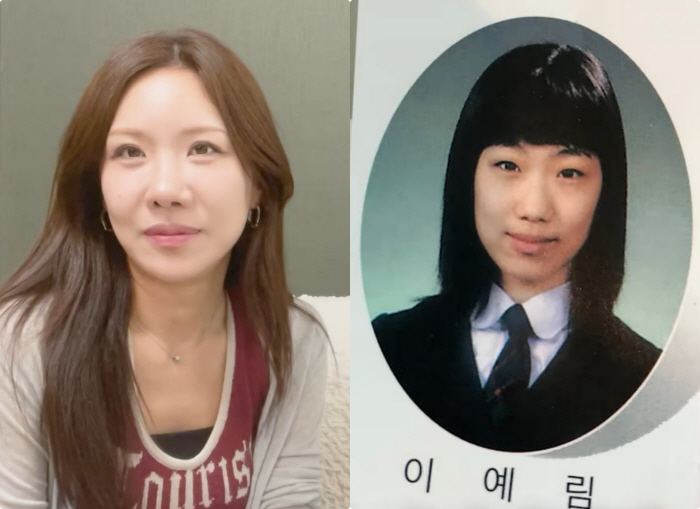 '성형만 13번' 연예림 "외모 자격지심에 눈 8번, 코 3번, 가슴+윤곽..지금도 예쁘지 않아"