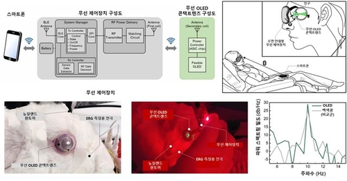 머리카락 굵기 8분의 1 OLED 넣은 렌즈로 눈 질환 검사한다