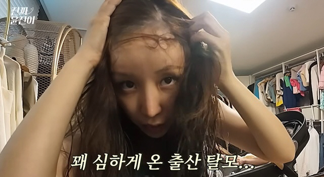 윤진이, 출산 탈모로 '머리가 텅'.."미친 듯이 빠져" 심각