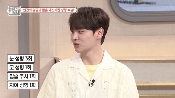 박서진, 성형비용 '억대' 이유 "코·눈 3번, 모발이식...시술은 6개…