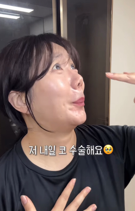 허안나, 구축코 재수술 "성형한 코 들리면서 삐뚤어져 속상"