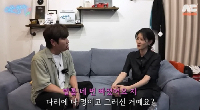 '발톱 4번 빠진' 이현이 "'골때녀' 산재보험 처리 받았다"