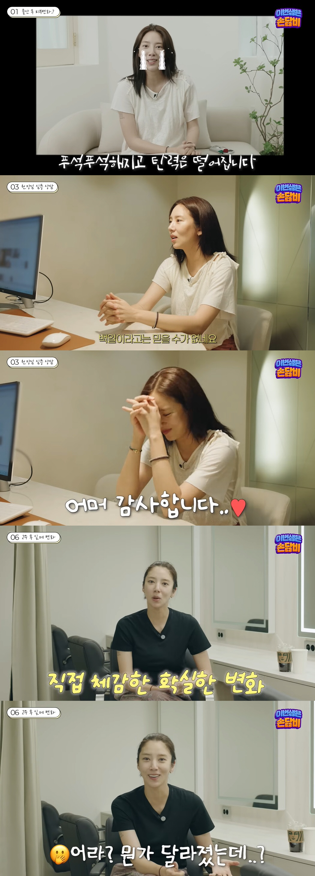 손담비, 출산 90일만 13kg 감량+리프팅 시술..달라진 얼굴에 만족