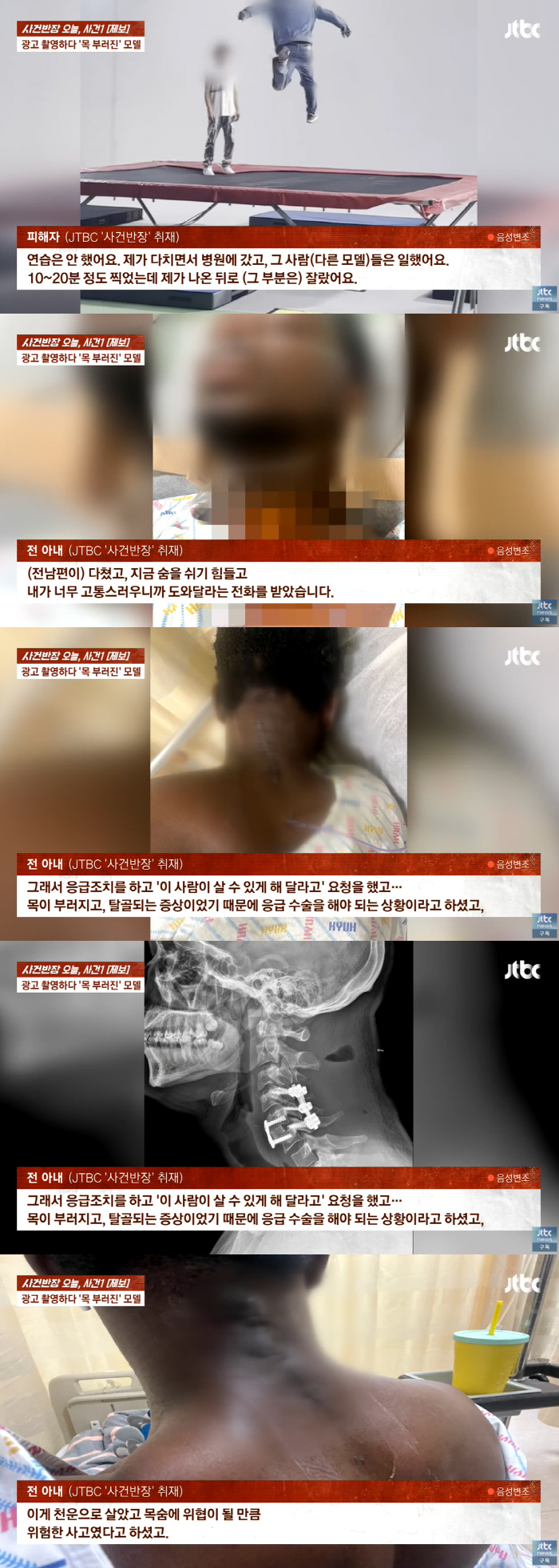 광고 촬영하다 ‘목 부러진’ 모델..“보상은 커녕 사과도 없어”