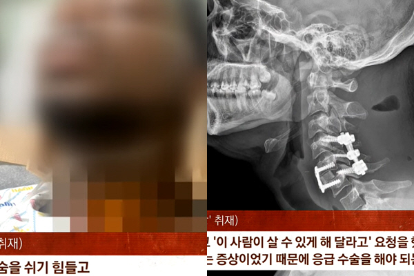 광고 촬영하다 ‘목 부러진’ 모델..“보상은 커녕 사과도 없어”