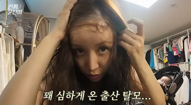 윤진이, 두 딸 출산 후 충격적인 탈모 상태 공개 "머리가 한 움큼씩 빠…