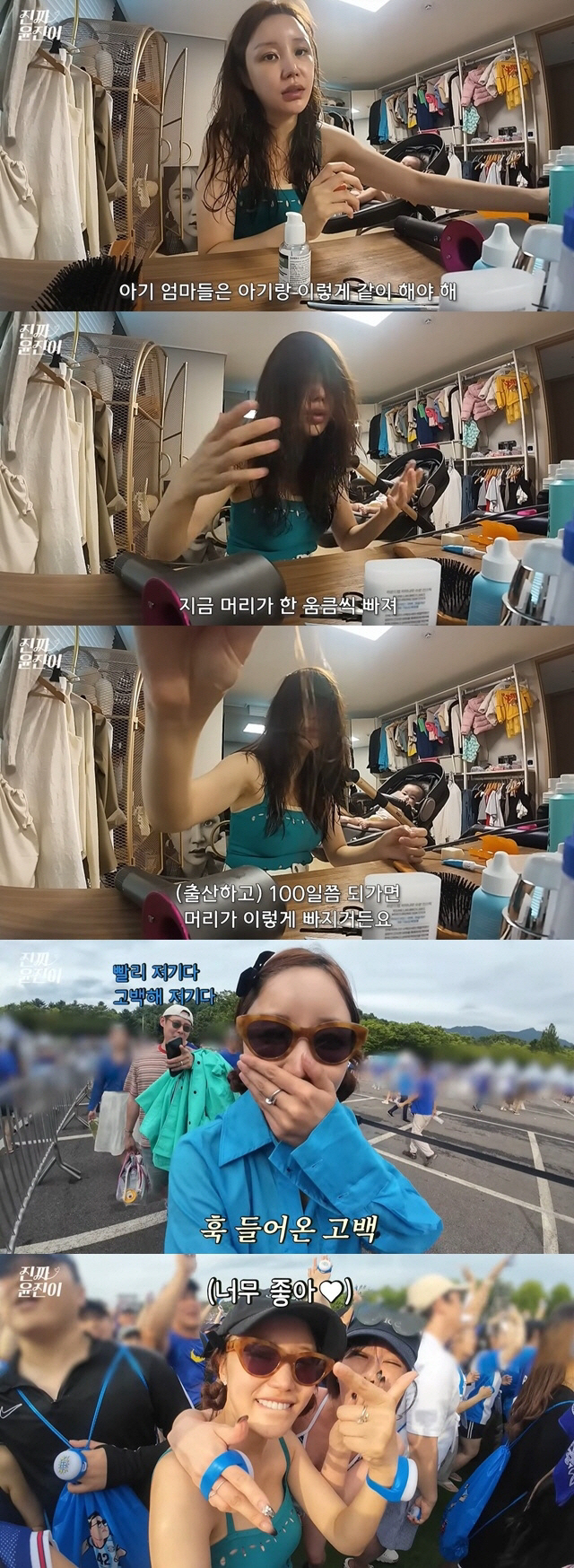 윤진이, 두 딸 출산 후 충격적인 탈모 상태 공개 "머리가 한 움큼씩 빠…