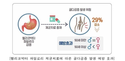 보건연구원 "헬리코박터 제균 치료, 골다공증 위험 29%↓ 효과"