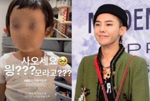 지드래곤 붕어빵 조카 