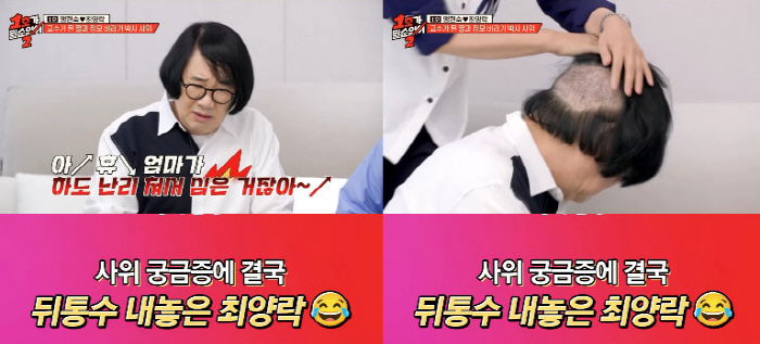 최양락, 모발이식 후 '휑한' 뒤통수 강제 공개..."사위 앞에서 창피해…