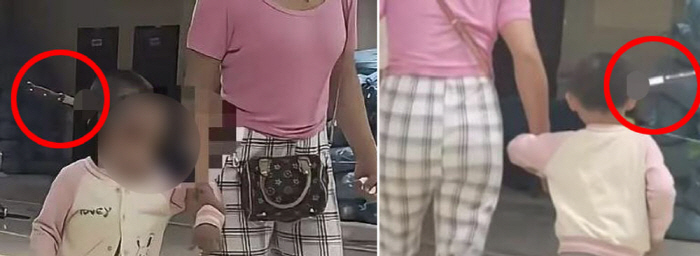 머리에 칼 꽂힌 3살 소녀, 병원에 걸어들어와…찔린 이유 '황당'
