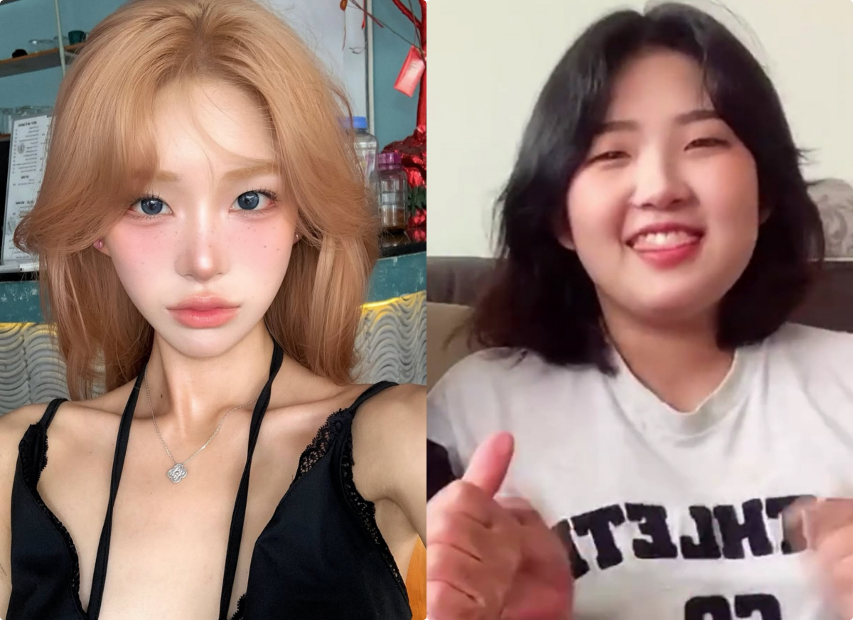 '최진실 딸' 최준희, 성형 전 과거사진에 충격 "처참 그자체"