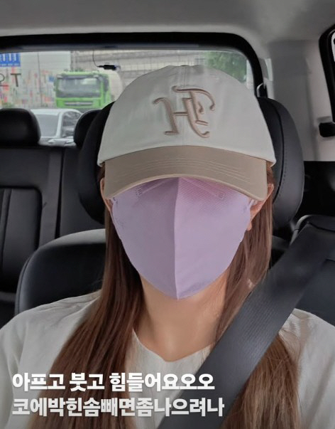 '이용규♥' 유하나 "싼 티 나는 코" 팩폭에 20년 만 재수술