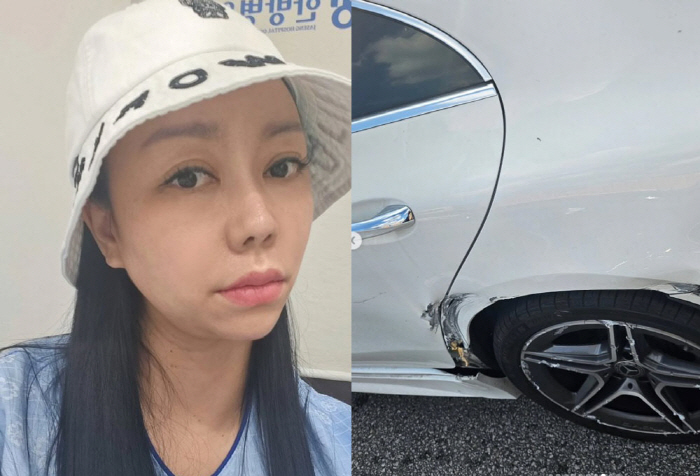 10기 정숙, 교통사고로 외제차 '대파'…"안 아픈 곳 없다"