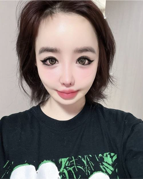 '건강이상' 박봄, 빨갛게 충혈된 눈…2NE1 활동까지 중단했는데[SCi…