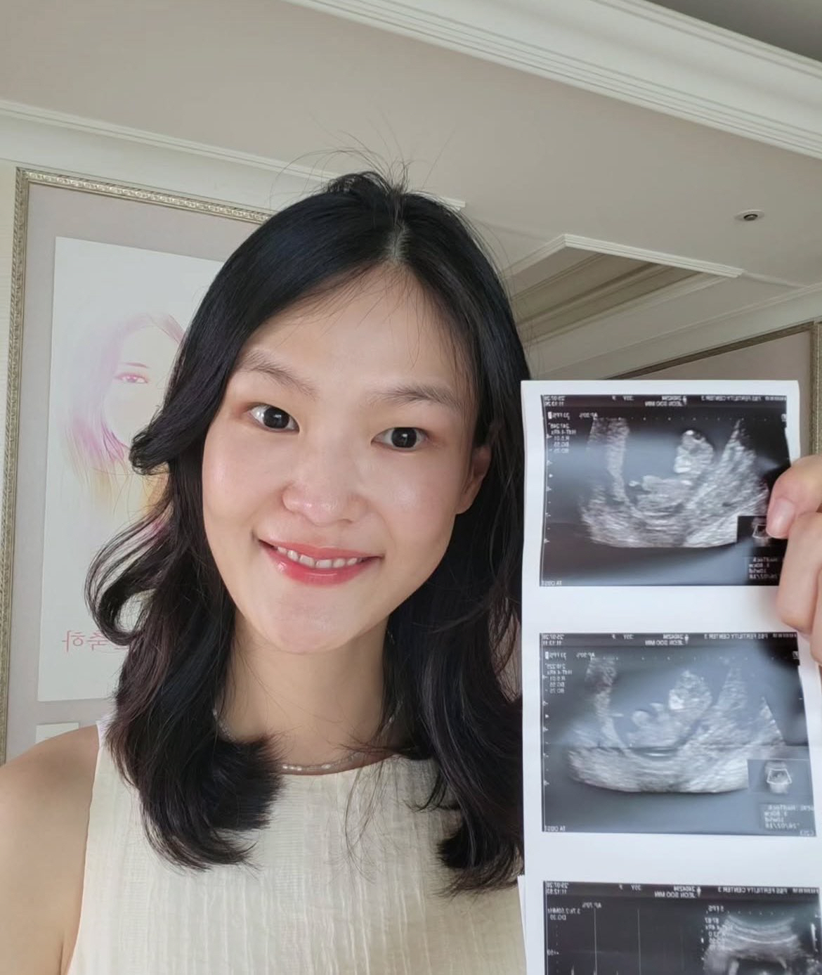 김경진♥전수민, 결혼 5년 만에 부모 돼..“기적 같은 선물”
