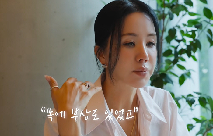 '갑상선암 수술' 엄정화, 안타까운 심경 "콘서트날 주저 앉아 울고 싶었…