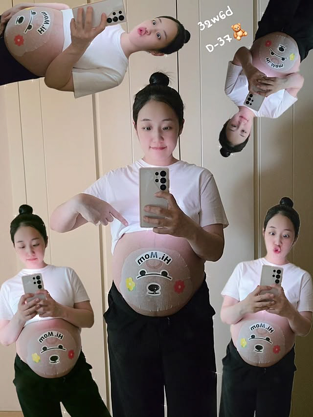 박보미, 아들상 2년만 임신..역대급 증상 "갈비뼈 통증·역류성 식도염까…