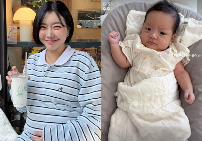 레이디제인, 쌍둥이 출산 한달만 안타까운 소식..선명한 '눈밑 혈관종'