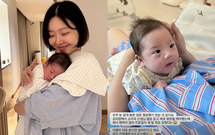레이디제인, 쌍둥이 출산 한달만 안타까운 소식..선명한 '눈밑 혈관종'