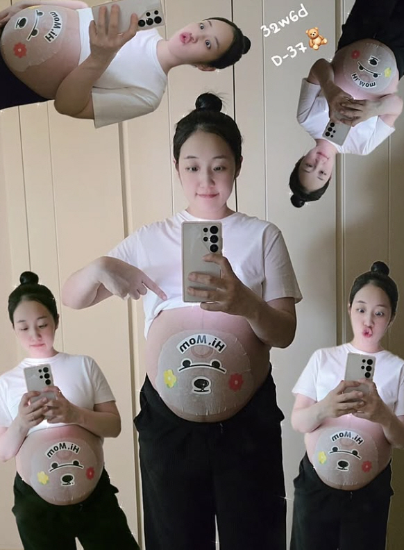 박보미, 만삭 D라인에 얼굴이 하나 더…"색소침착+임신선 증상"[SCin…