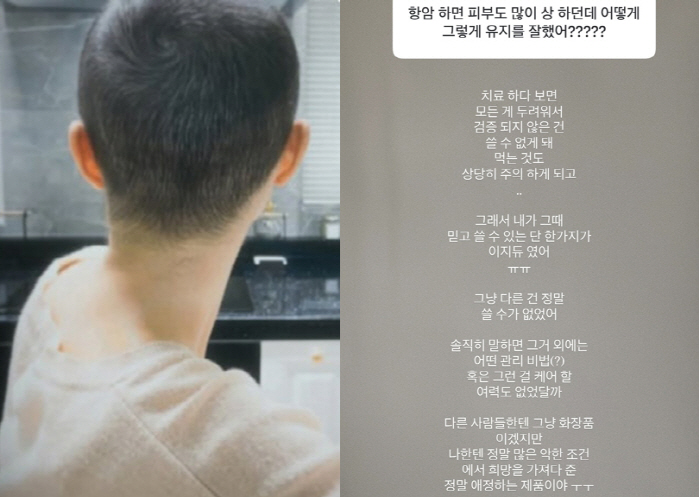 '박성광♥' 이솔이, 암투병 항암치료 후유증 "머리 다 빠지고 피부 까매…