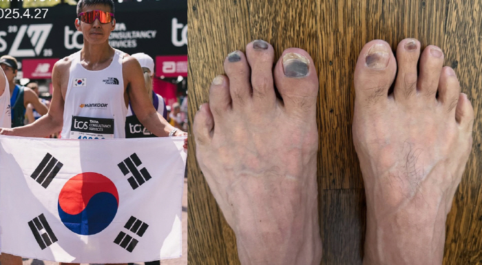‘52세’ 션, 광복절 마라톤 후 심각한 발 상태..“영광의 훈장”