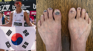 ‘52세’ 션, 광복절 마라톤 후 심각한 발 상태..“영광의 훈장”