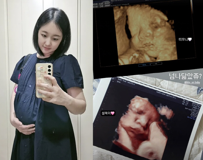 '아들상 딛고 임신' 박보미, 둘째 초음파에 뭉클 