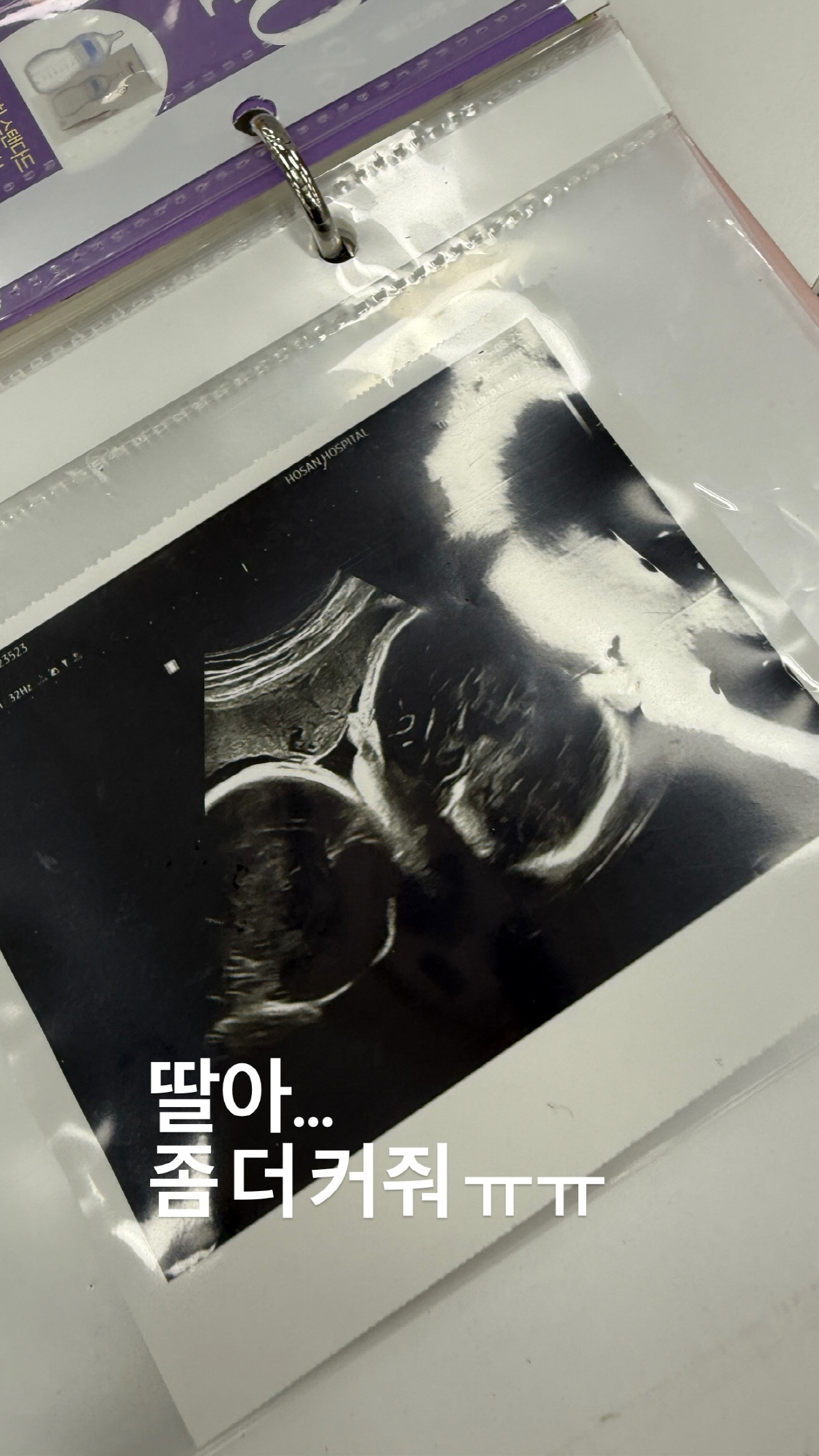 '쌍둥이 임신' 지소연, 안타까운 눈물...뱃속 작은 딸에 "좀 더 커줘…