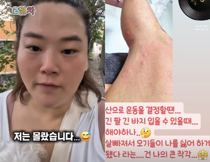 미나 시누이, 요요 후 100kg..연이은 악재로 다리까지 퉁퉁 부어 '…