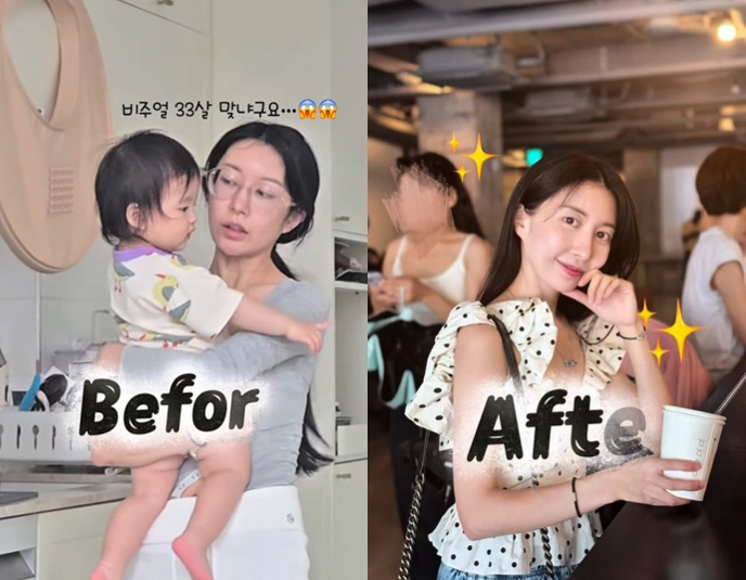 '이지훈♥' 아야네, 렌스삽입술 수술 후 광명 찾았다 "왜 이제서야 했나…