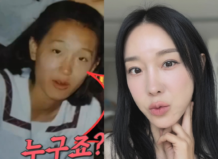 이지혜, 성형 전 사진 폭로...못 알아보게 다른 얼굴에 "죽은 동생 하…